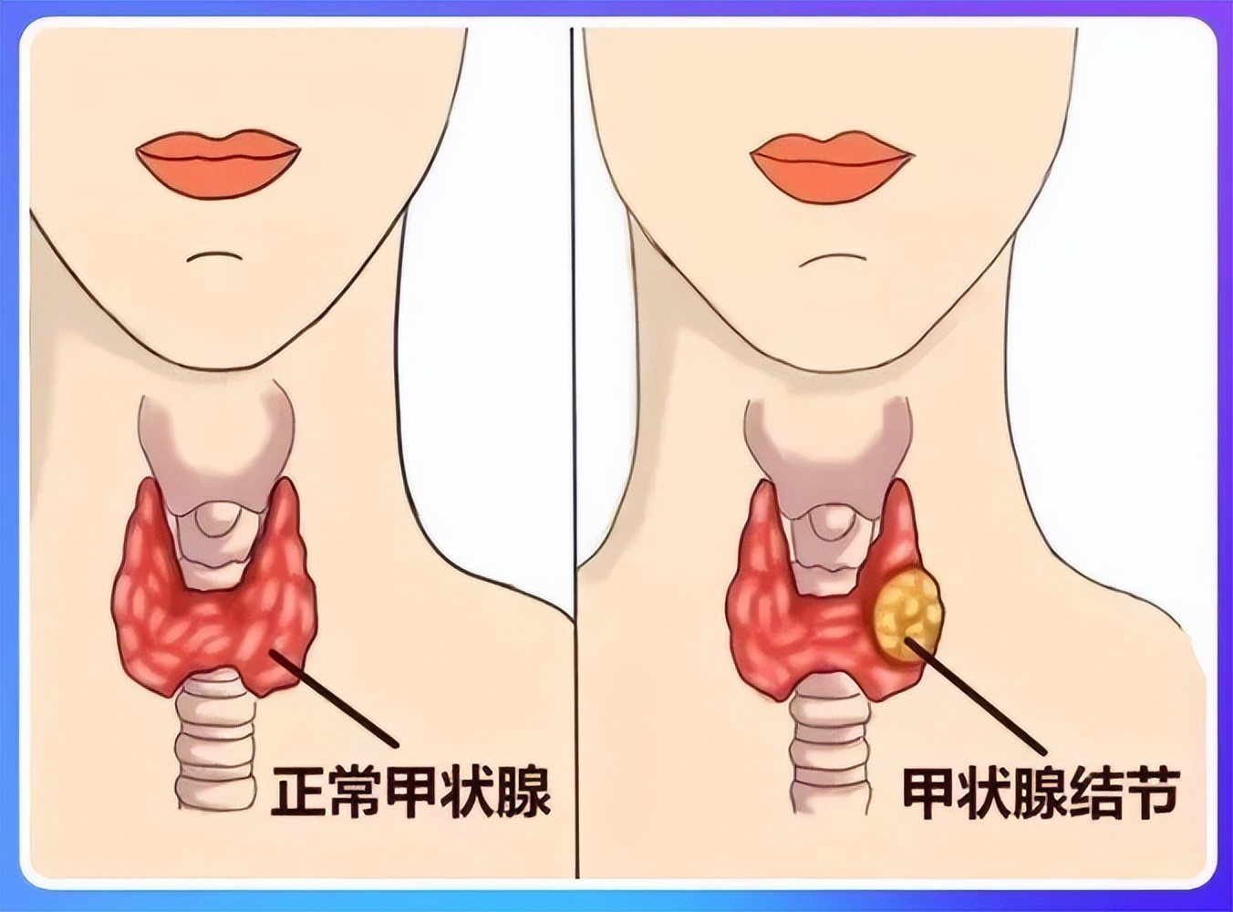 美丽的蝴蝶,美丽的蝴蝶完整版