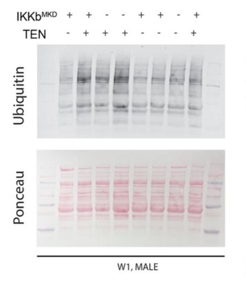 核因子,NFκB,在临床治疗上,是否与腱切断术的肌肉萎缩无关?