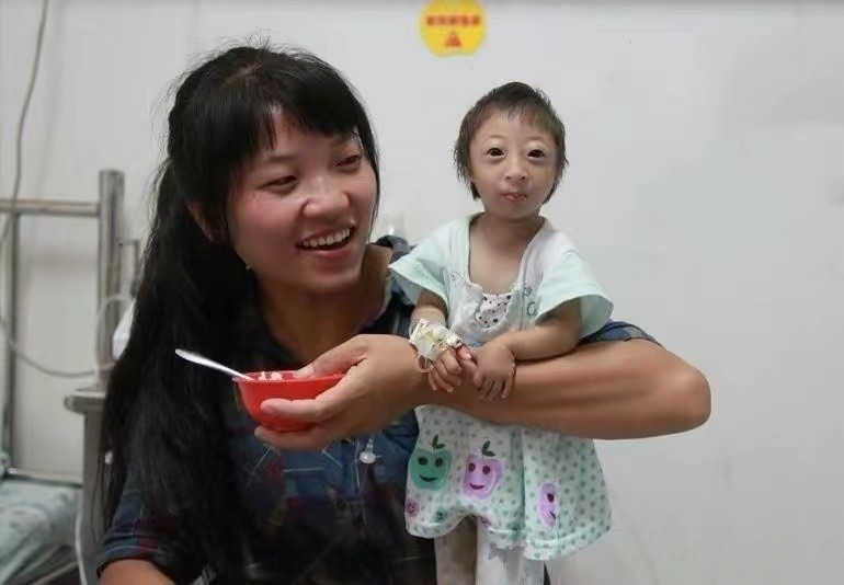 袖珍女孩梁小小出生日期,袖珍女孩梁小小现在长大的样子