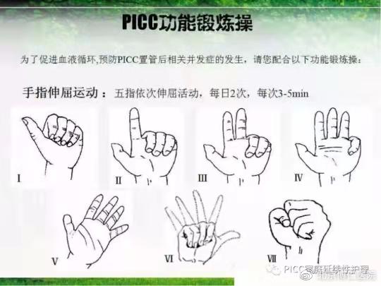 不扎针的输液管,不扎留置针静脉输液