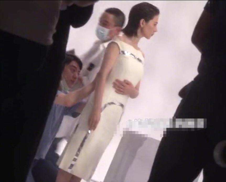 面部衰老皱纹解剖图,面部皱纹衰老对比图