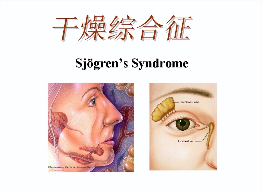 慢性病造成的肾脏伤害怎么治疗,自身免疫性疾病会引起哪些病