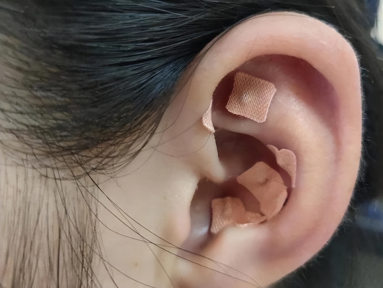 2型糖尿病合并便秘怎么办？中医证型有哪些？临床上有何治疗办法