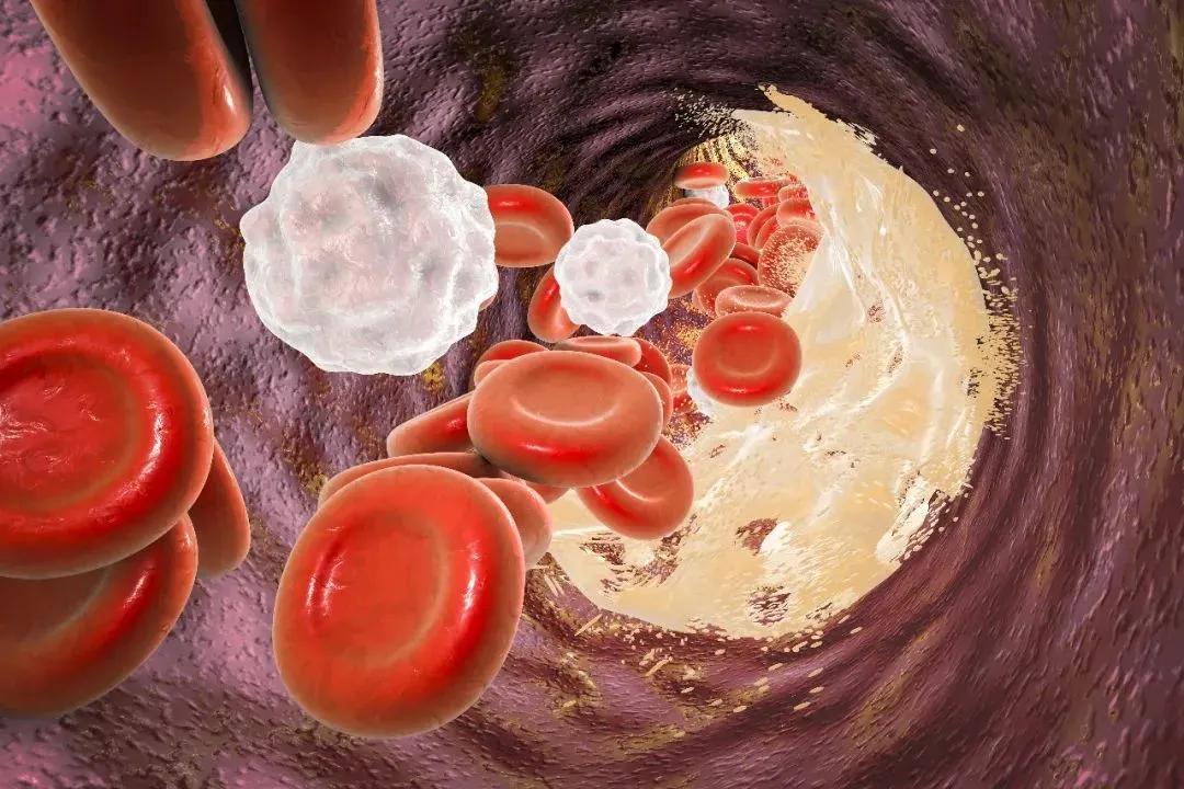 警惕七种眼病,警惕眼部出现这些问题