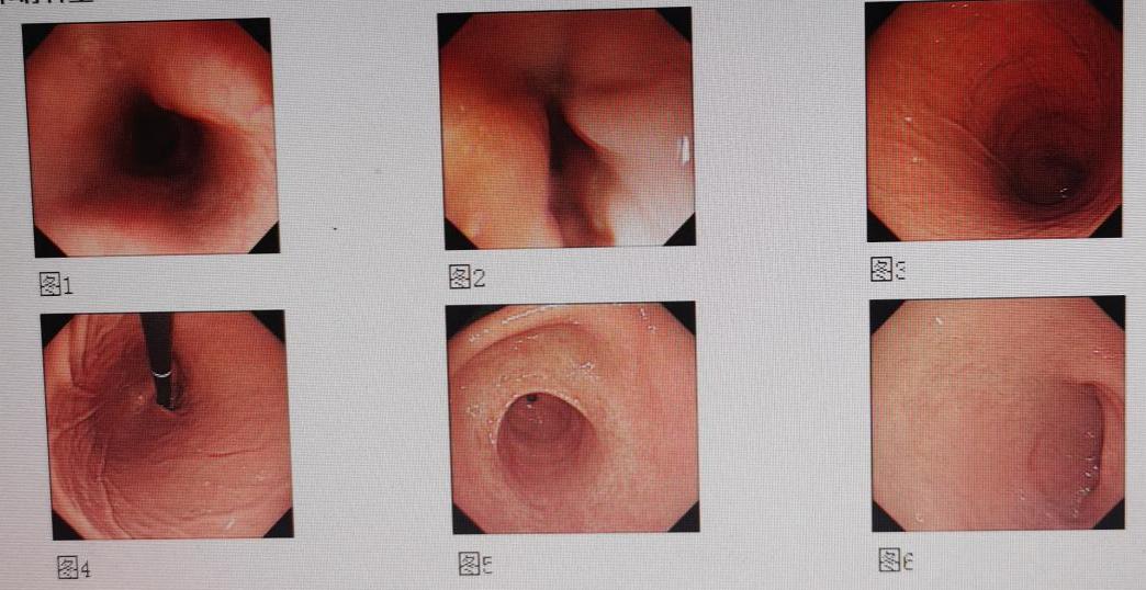 呕吐腹泻腹痛发烧是属什么病症,呕吐腹痛腹泻是什么原因引起的