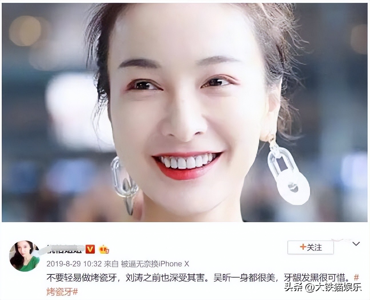 张嘉倪“假屁股”揭露了女星的伪精致，从头假到脚，还有啥是真的