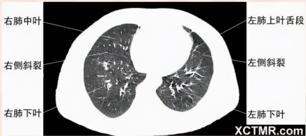 胸腹部盆腔ct主要检查什么,女性盆腔ct断层解剖结构图