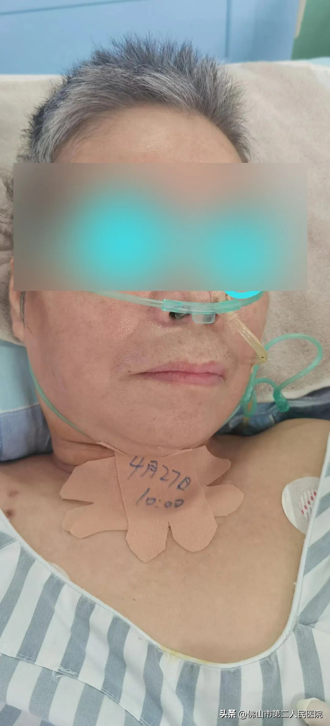 佛山市第二人民医院康复科颈椎病,佛山市中医院康复科怎么样