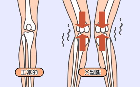 爸妈腿疼,爸妈腿疼怎么办