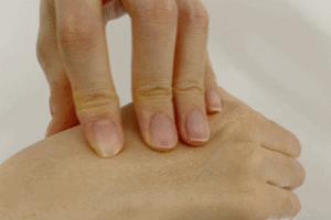 头皮发痒有头屑是什么原因,头皮发痒头屑多的原因和解决方法