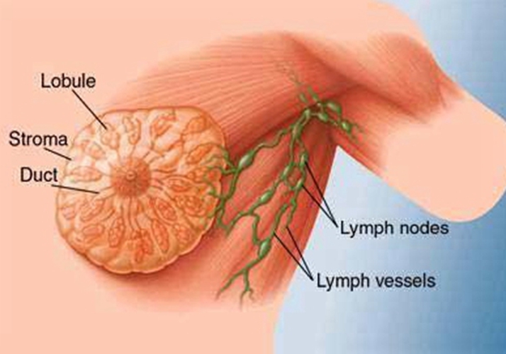 保乳术后的放射治疗