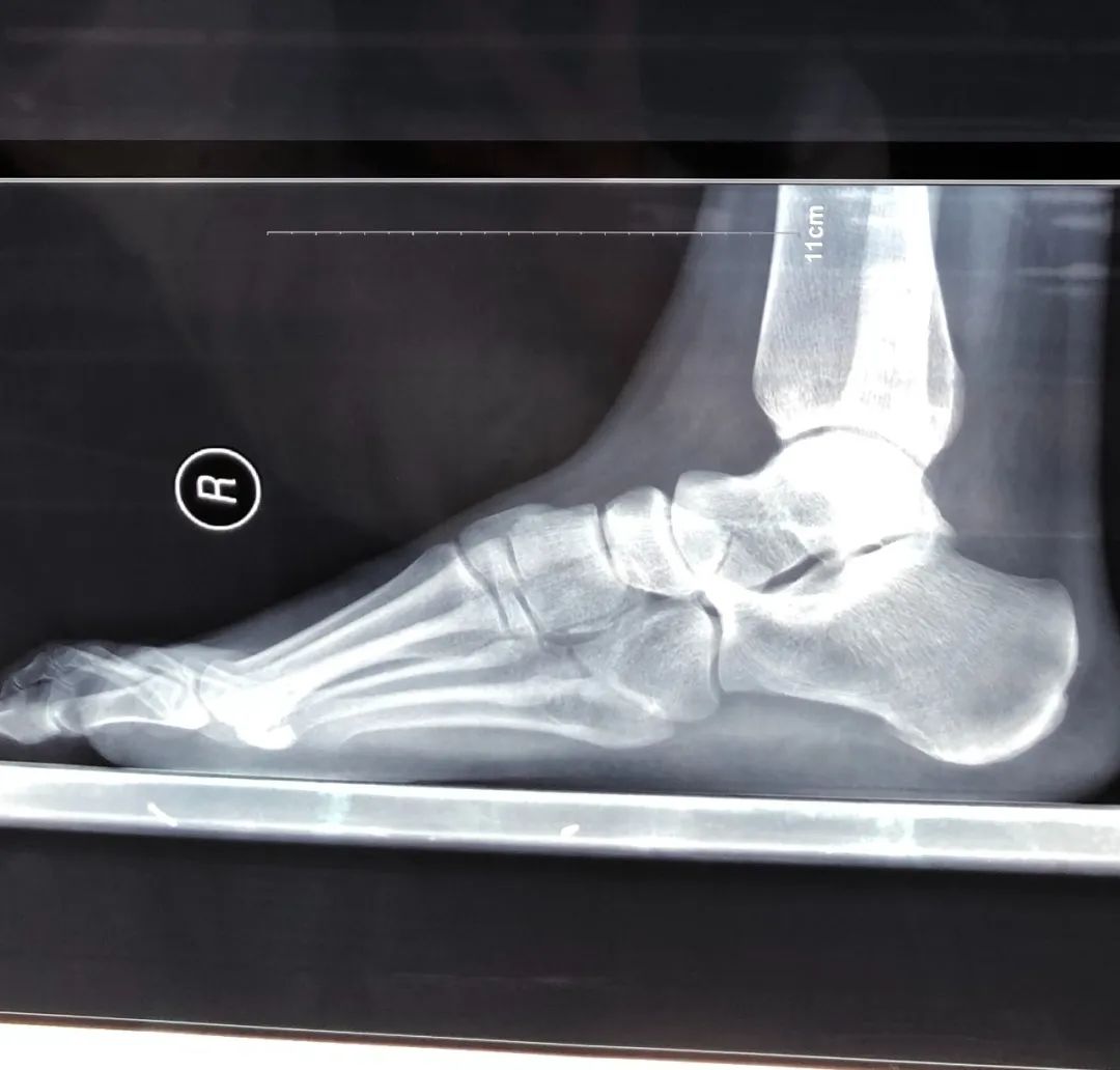 7月份人来人往街道,7月北京人山人海