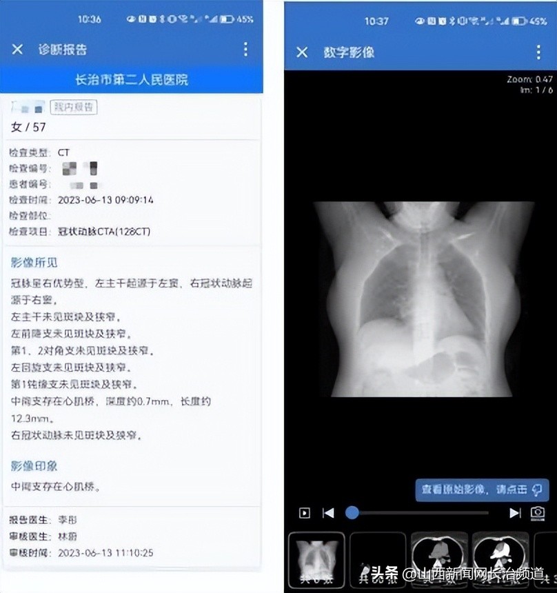 长治市第二人民医院网上挂号,长治市第二人民医院挂号