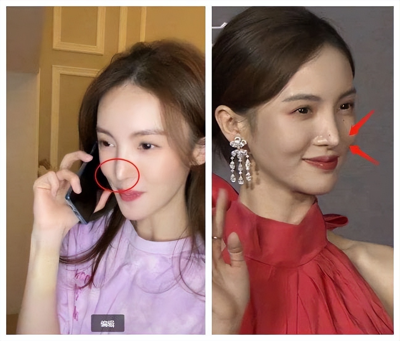 哪些明星整容后遗症越来越严重,整容明星后遗症对比图片