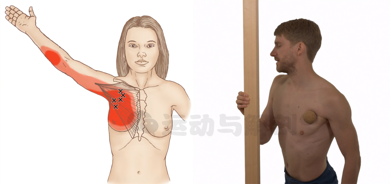 胸大肌紧绷不舒服怎么调理,胸大肌紧绷是什么原因