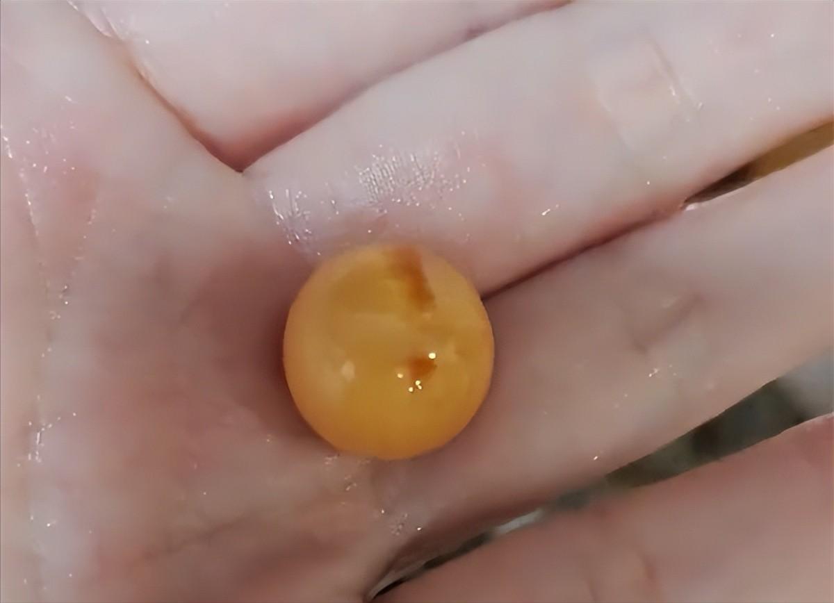 山东一女子吃出龙珠,安徽女子吃椰子螺吃出龙珠