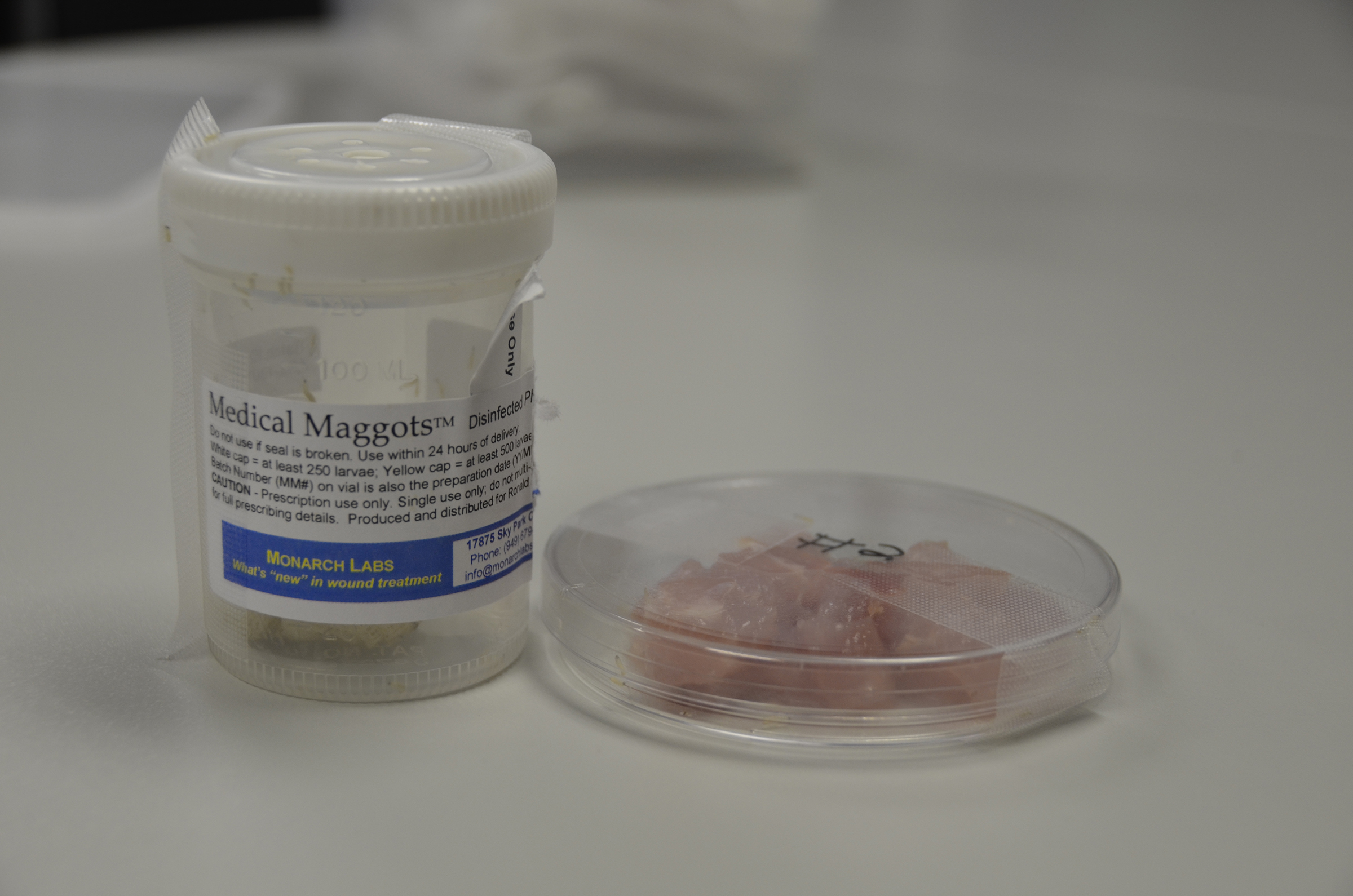 为啥身上会长蛆虫,人身上有蛆虫是什么原因