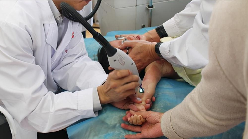 小孩身上的红痣可能是血管瘤,幼儿身上小红点富贵痣竟是血管瘤