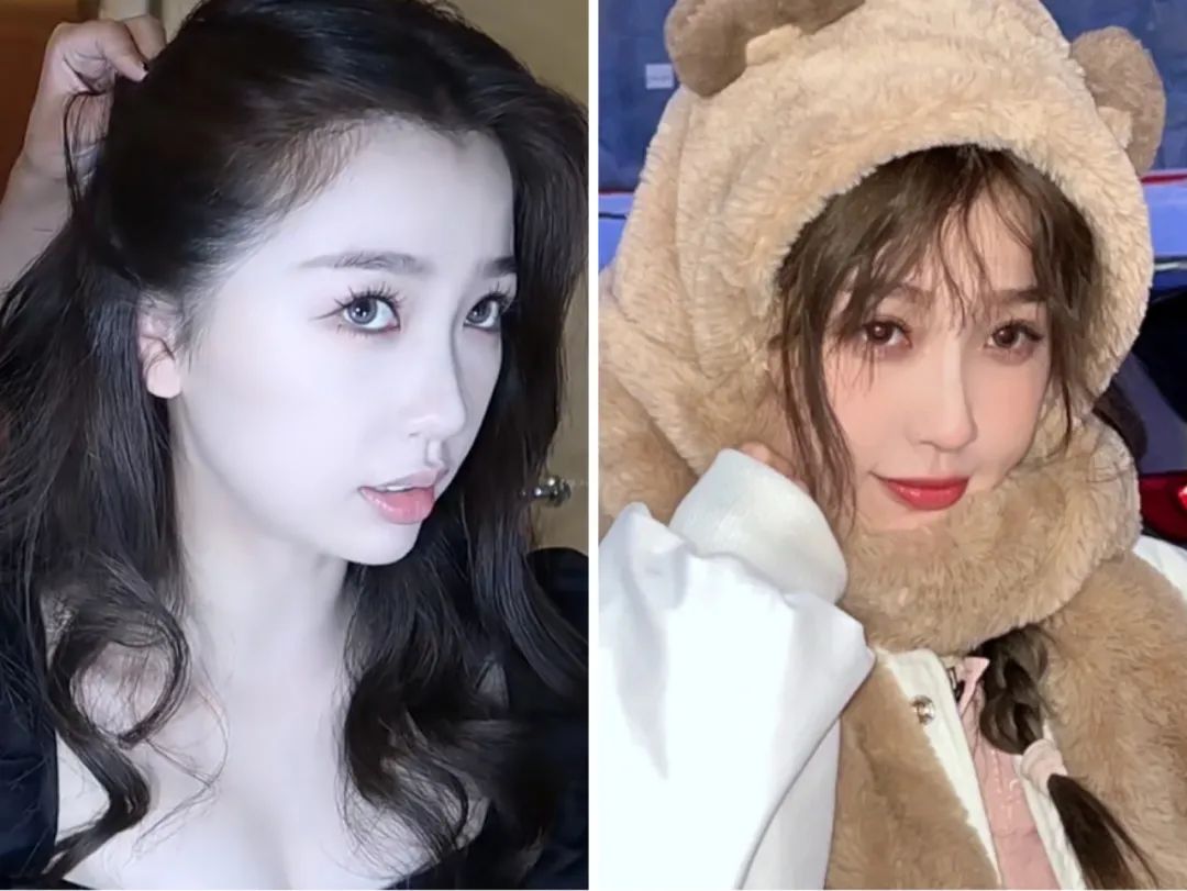 虞书欣圆脸变微脸的方法,虞书欣扁平脸改善