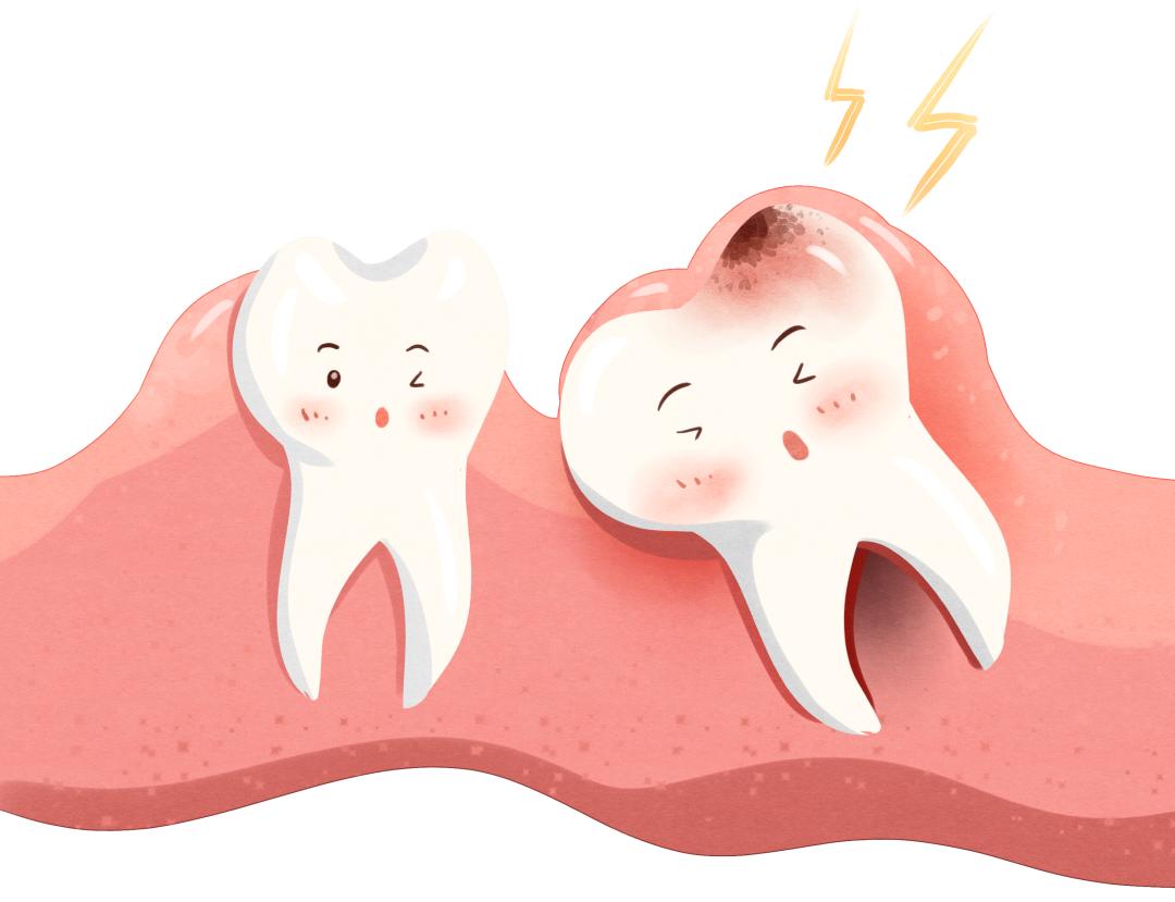 智齿不痛但是不舒服,智齿到底要不要拔医生告诉你答案