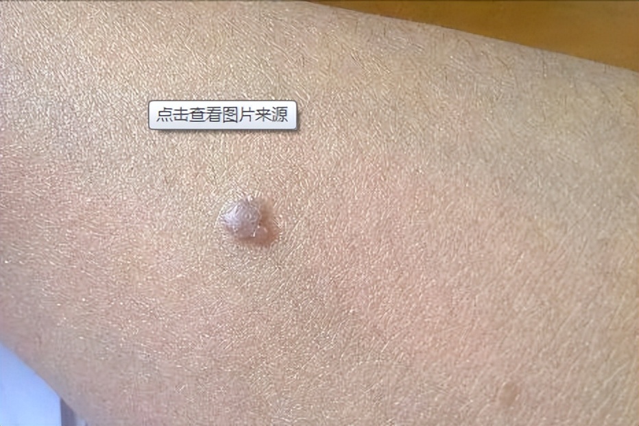 打九价会不会影响经期,打九价会影响来例假吗