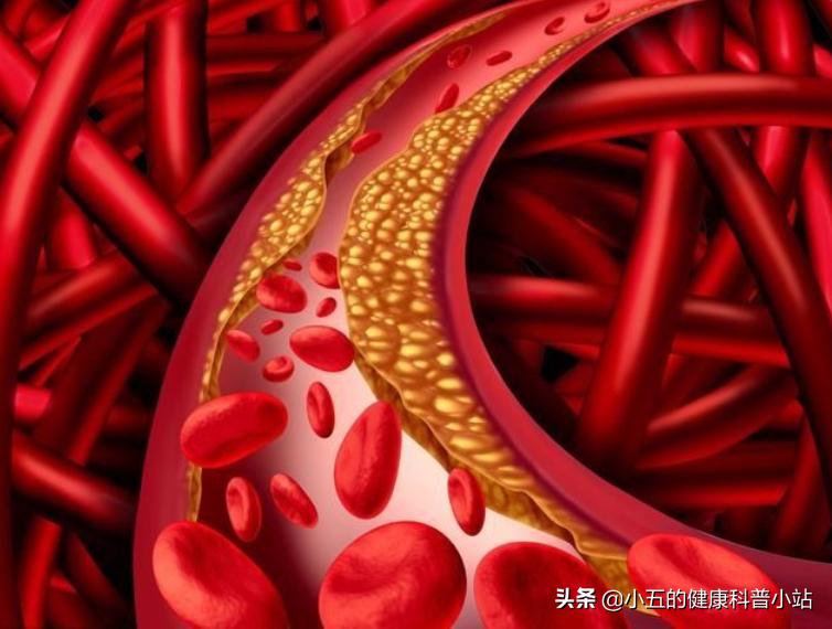 糖尿病长期吃药肾受损怎么办,糖尿病如何损伤血管的