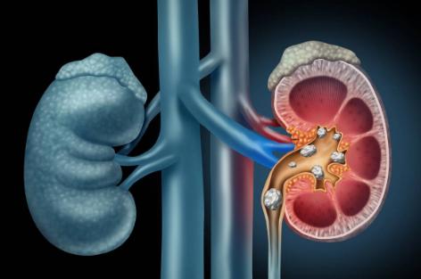 软性毒品一级致癌槟榔,槟榔危害这么大为何还要生产