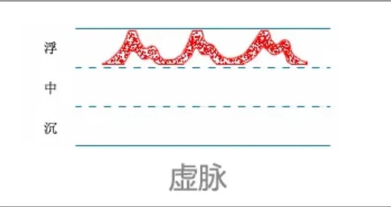 中医28脉诊歌诀及示意图,中医28脉全部脉象图解