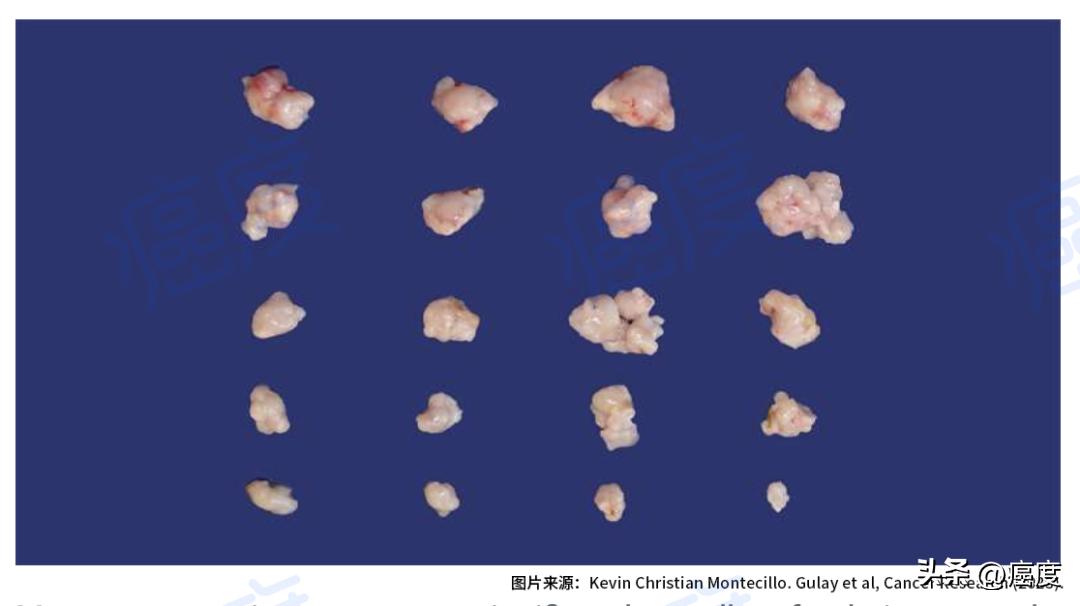 阿法替尼会缩小肿瘤吗,阿法替尼治疗肝癌吗