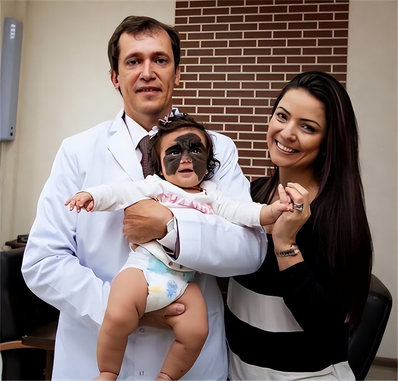 小女孩胎记后续,女童脸上长胎记去哪个医院