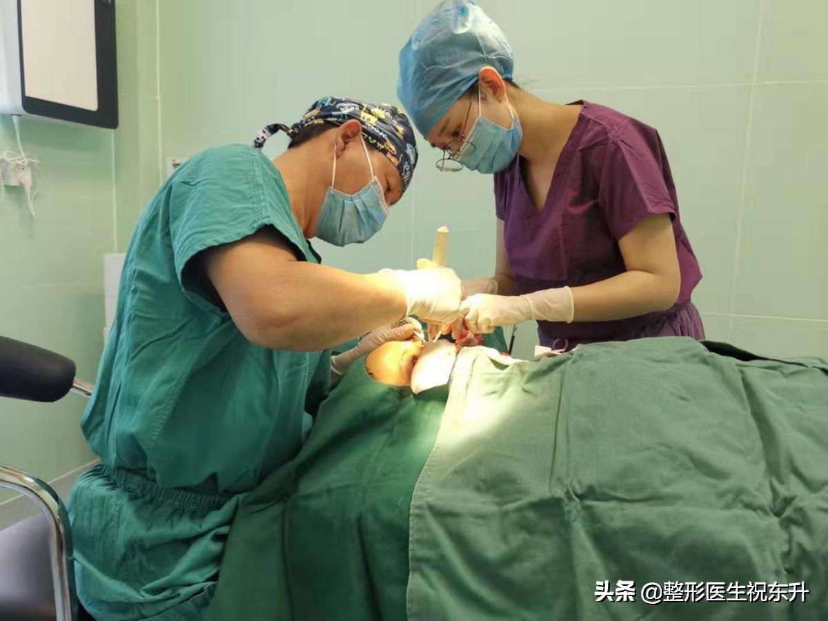 之前做了祛眼袋泪沟特别明显,北京去眼袋手术前后对比