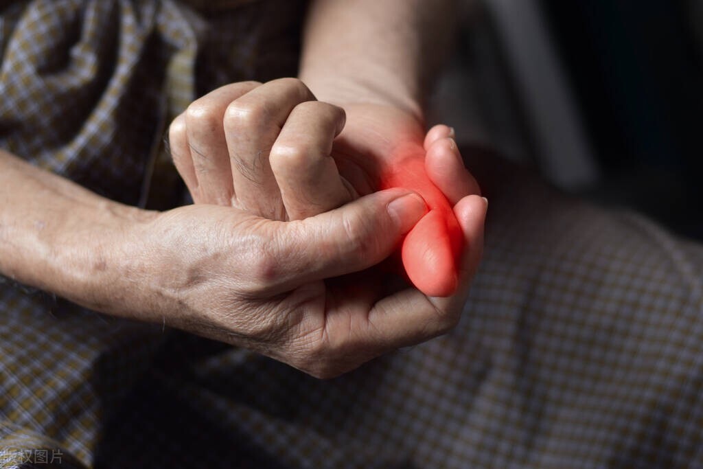 手指类风湿性关节炎最新治愈方法,类风湿关节炎手指发麻要怎么预防