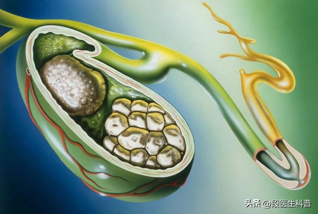 黄疸都有哪些明显症状,黄疸有哪些典型症状