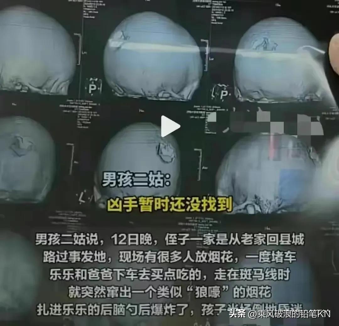 河南男童被烟花炸伤死亡,河南10岁男孩被烟花炸伤身亡