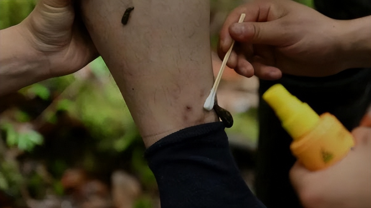 民警巡逻后身上清除蚂蟥,西藏民警巡逻被35只蚂蝗咬伤