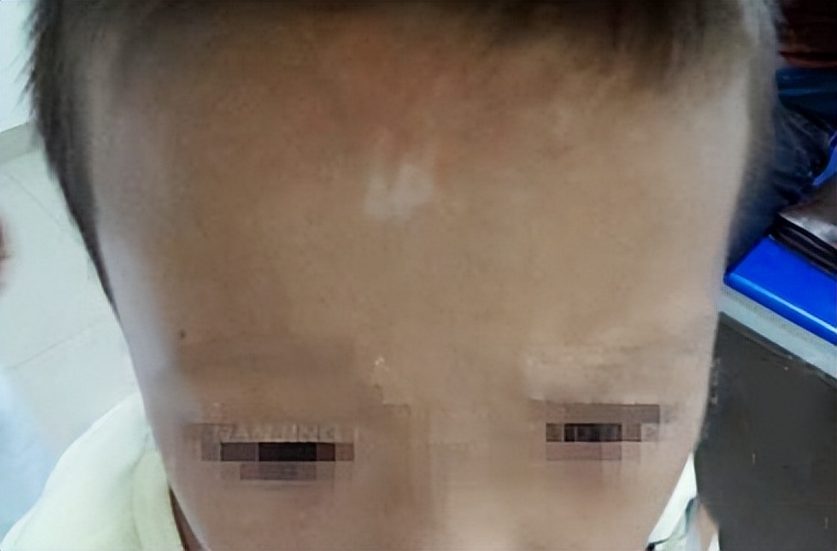 这些你必须知道的美容常识,哪些关于白斑的知识