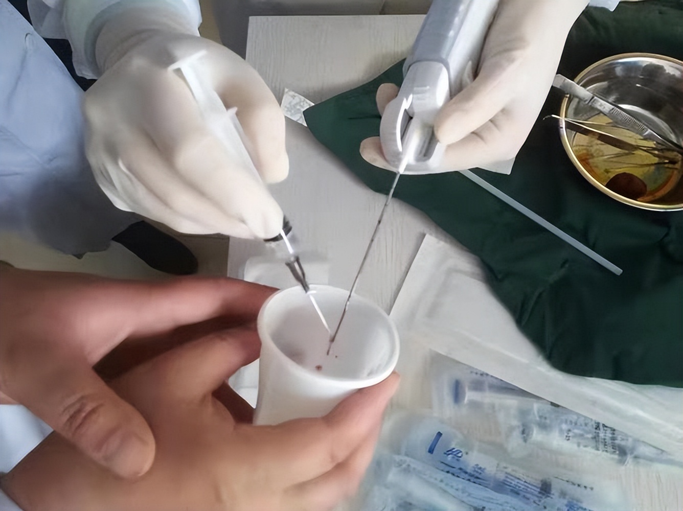 医生提醒大多数囊肿无需处理,请问囊肿有什么需要注意的吗