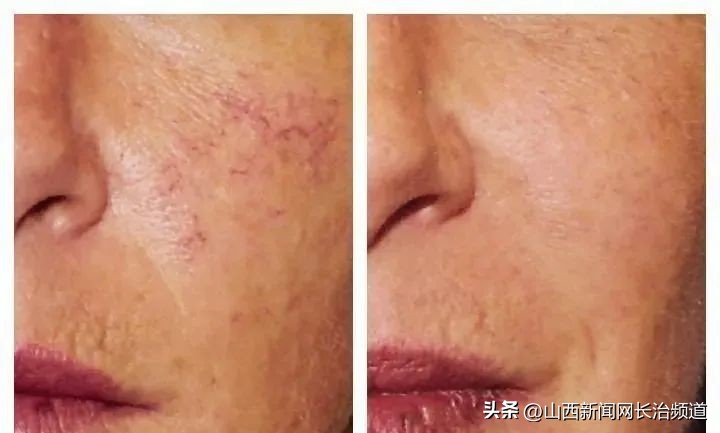 长治市人民医院整形科,长治市人民医院整形美容