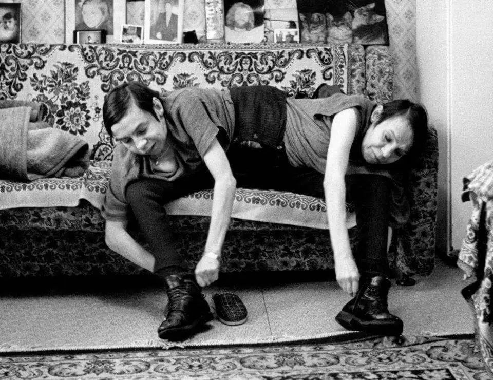 连体人结婚是怎样过日子,连体人如何娶妻生子