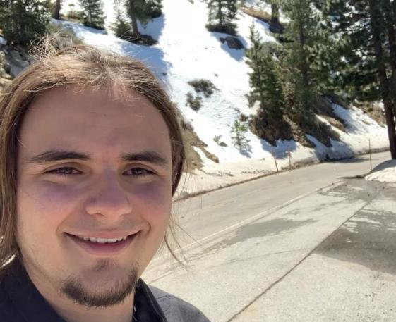 杰克逊大儿子遗传病,迈克尔杰克逊去世得了什么疾病