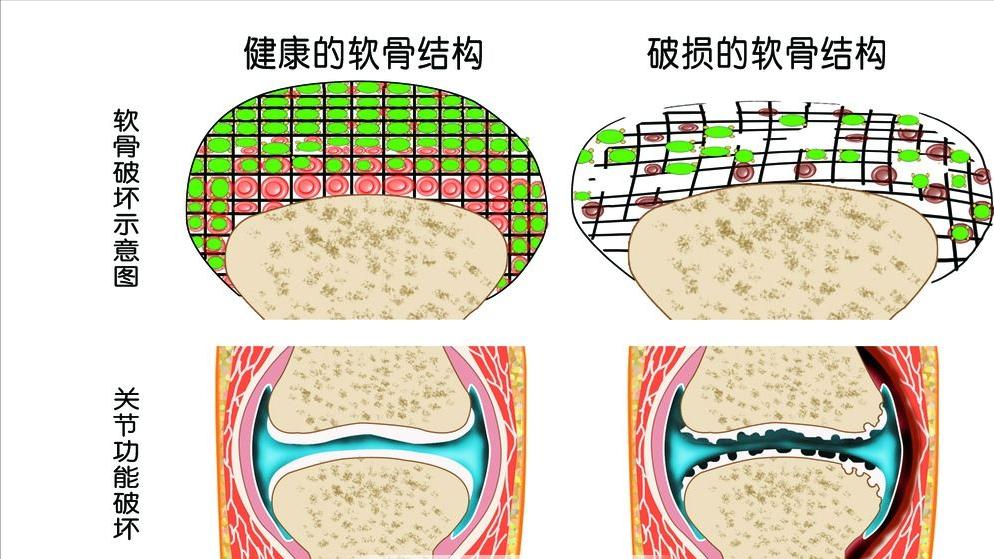 专治老年人下肢无力的方法,老年人下肢无力吃什么药