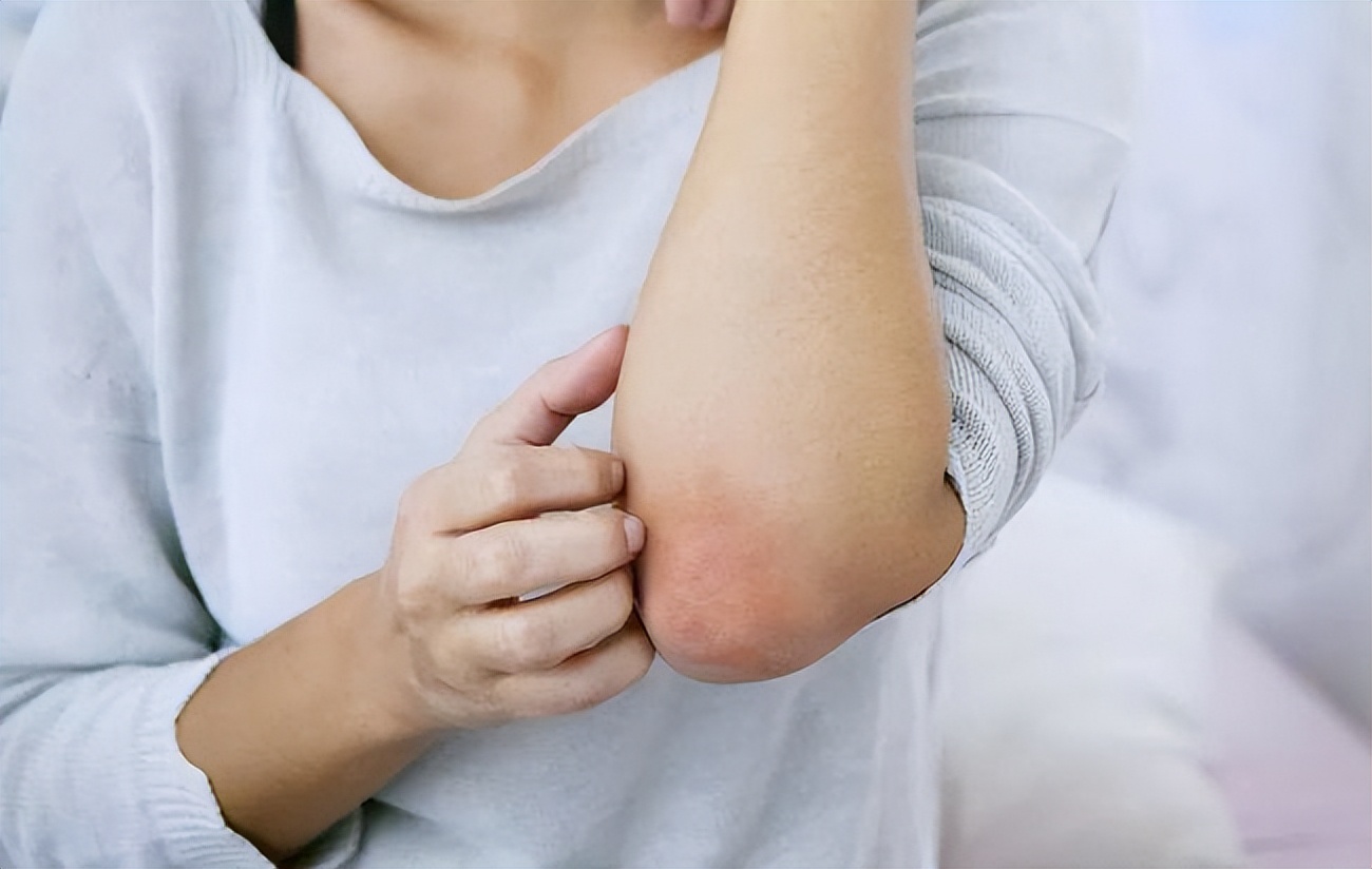 不要错把艾滋病当皮肤病,不要错把艾滋当成皮肤病