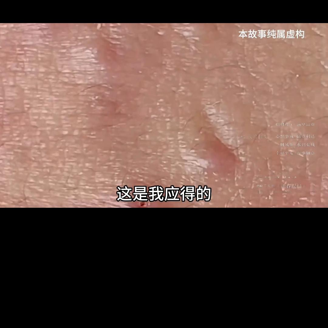 📖安安如招后续知乎#粉刺针的正确使用方法