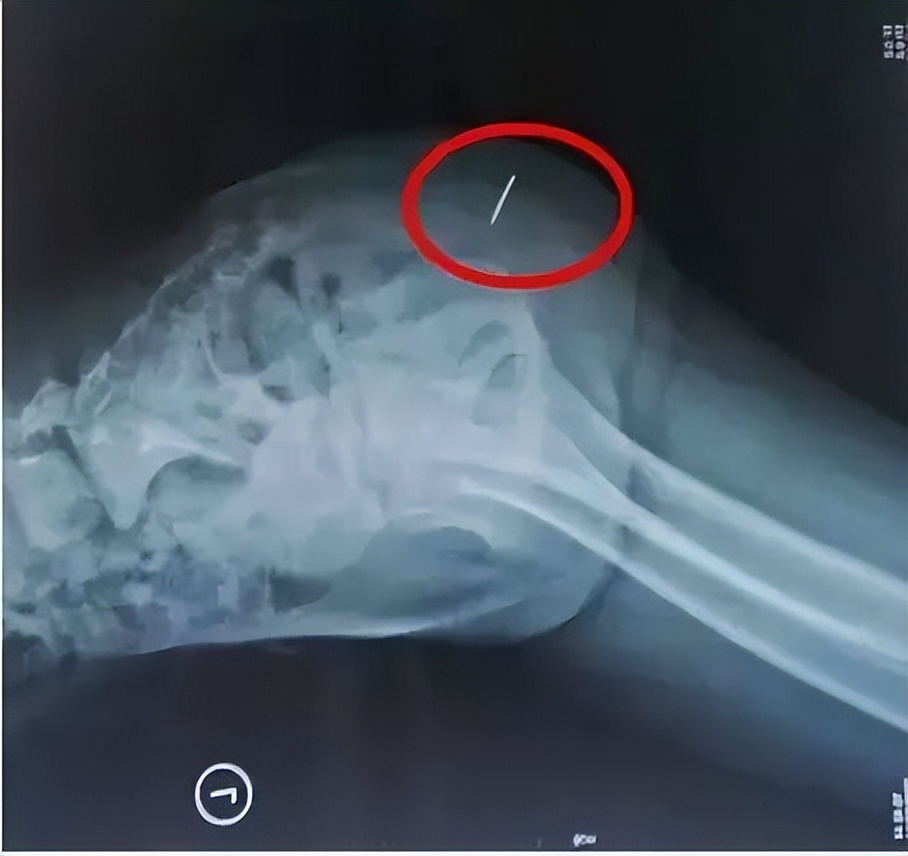 女幼童外阴红肿疼痛,女幼童外阴红肿疼