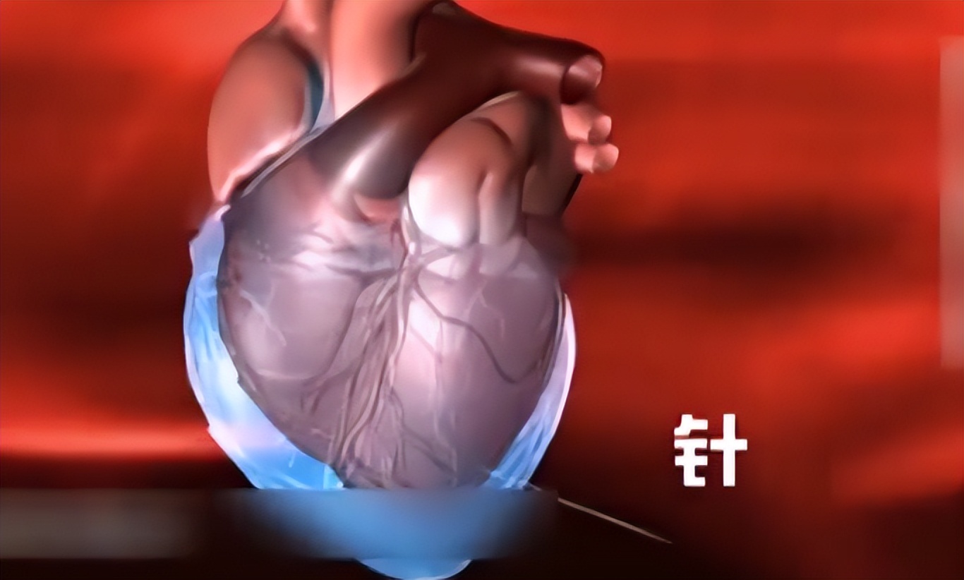 17岁男孩头痛被送进医院，医生一看X光片直接傻眼：没救了