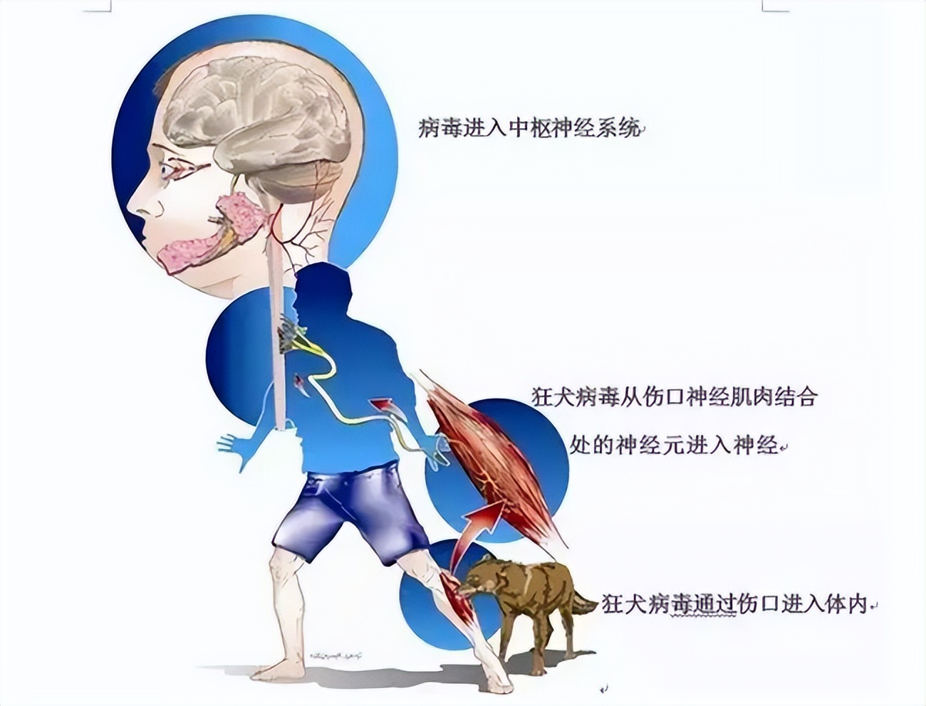 狂犬病和新冠变异,新冠狂犬病