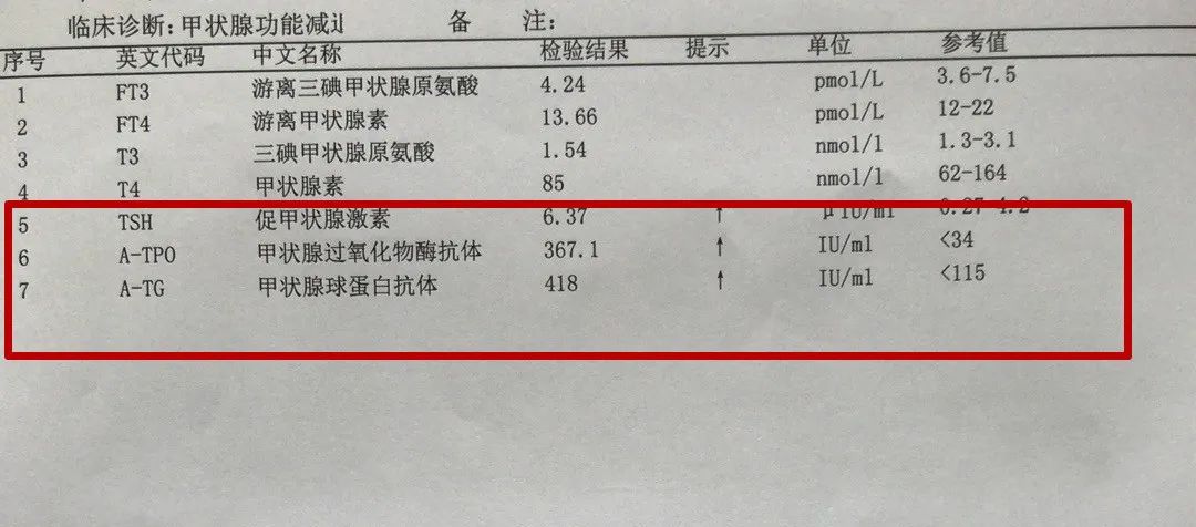 16岁女孩桥本氏甲状腺炎治疗,14岁女孩桥本甲状腺炎能治愈吗