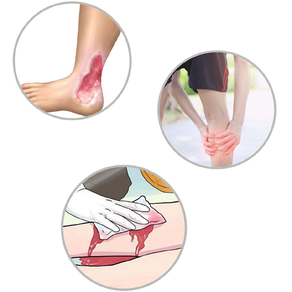 静脉曲张打高尔夫,打乒乓球静脉曲张怎么办