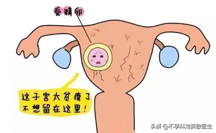 胚胎最爱什么样的内膜？怎么把薄内膜养成好内膜！