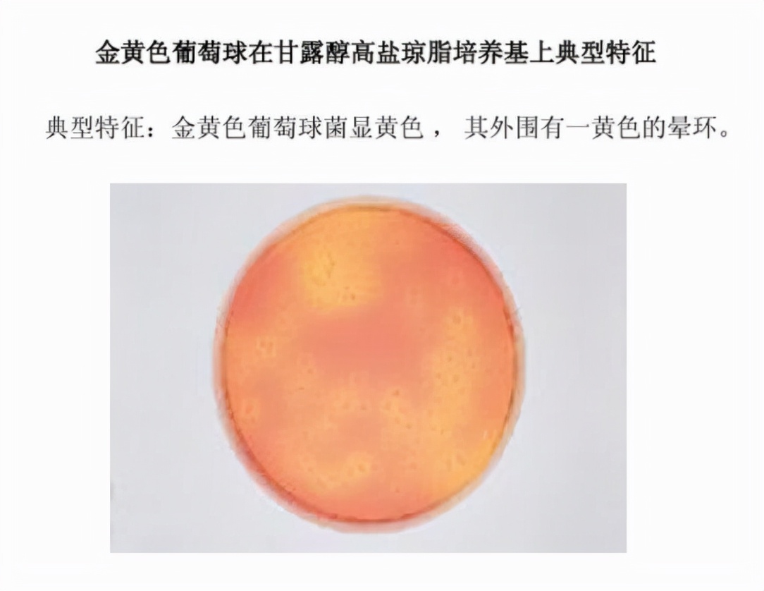 食源性过敏原,食源性致病菌引发的国际案例